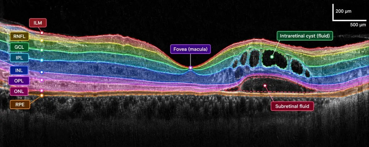Disease & Lesion Annotation and Dermatology & Ophthalmology Annotation